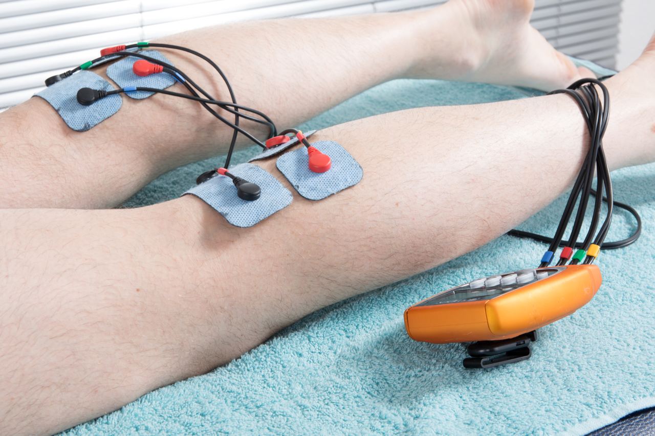 Электромиостимуляция - аппараты для стимуляции мышц, показания к применению, результаты использования