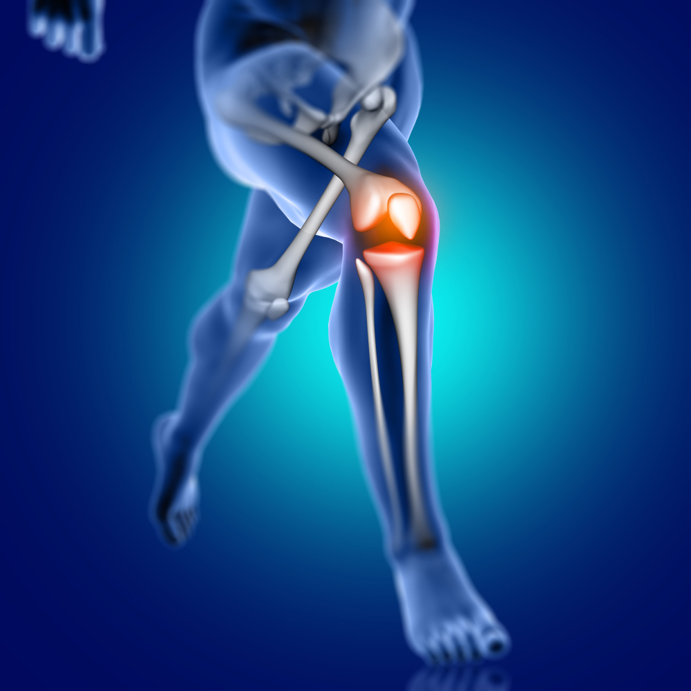 артроза коленного сустава